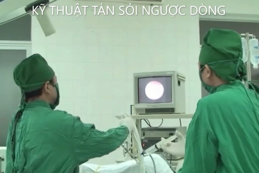 Kỹ thuật tán sỏi ngược dòng
