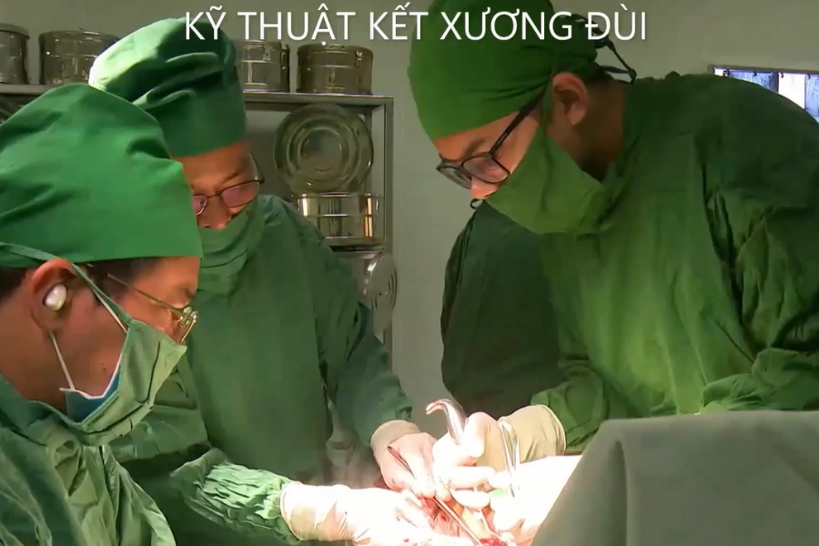 Kỹ thuật kết xương đùi