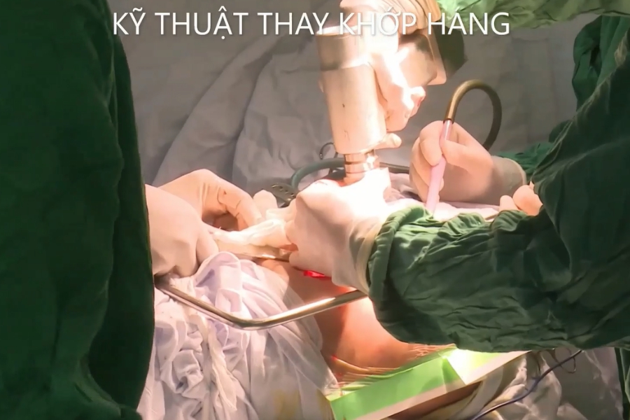 Kỹ thuật thay khớp háng
