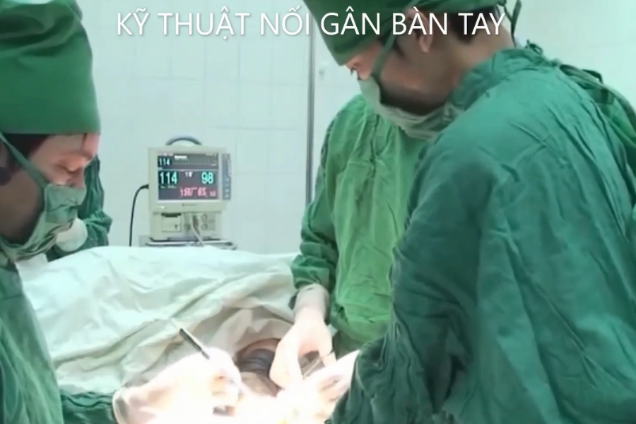 Kỹ thuật nối gân bàn tay